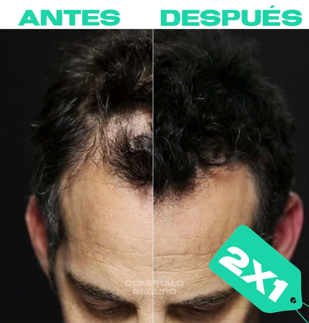 2X1 FIBRAS CAPILARES